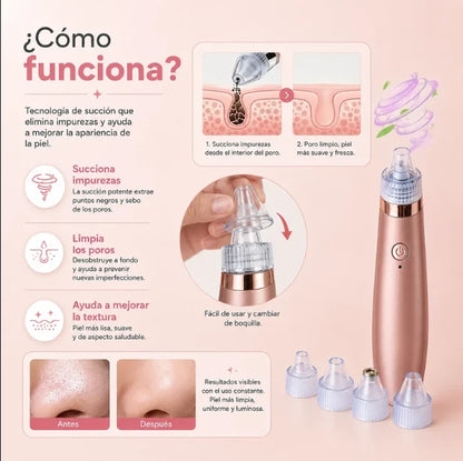 Limpiador de poros y acné XN-8030